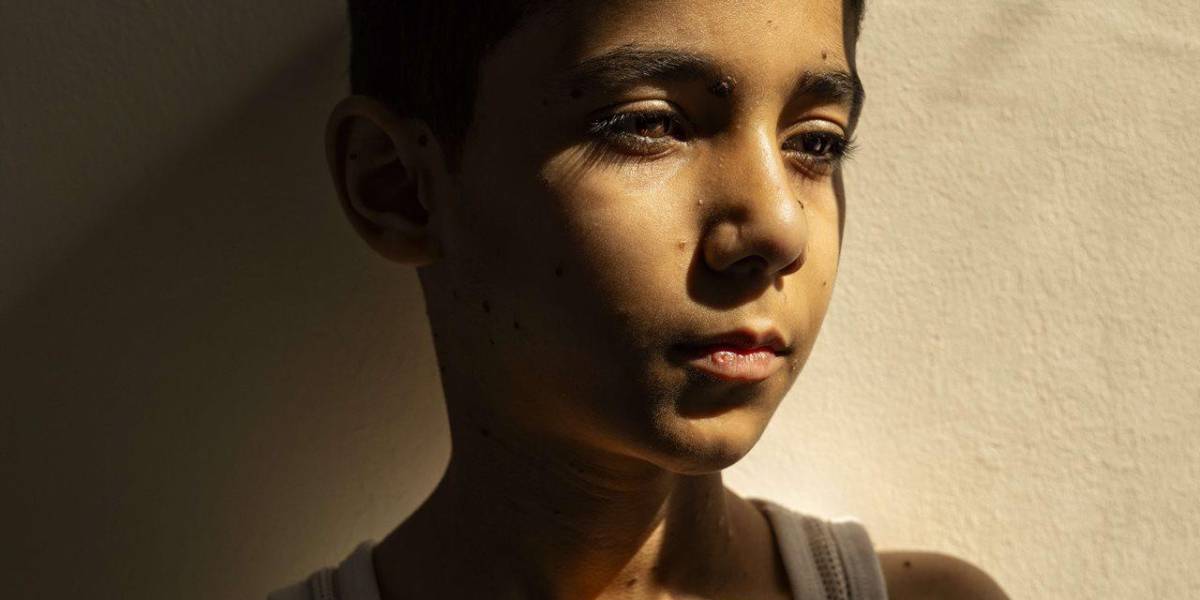 La imagen que conmovió al mundo: Niño gazatí sin brazos gana el World Press Photo 2025