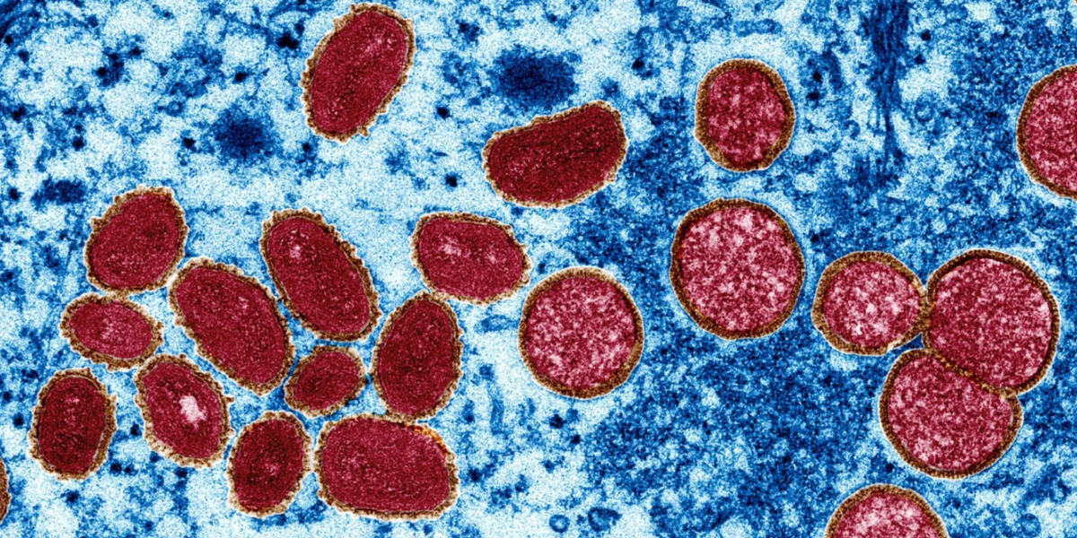 Ecuador suma 120 casos de viruela del mono, 74 están en aislamiento