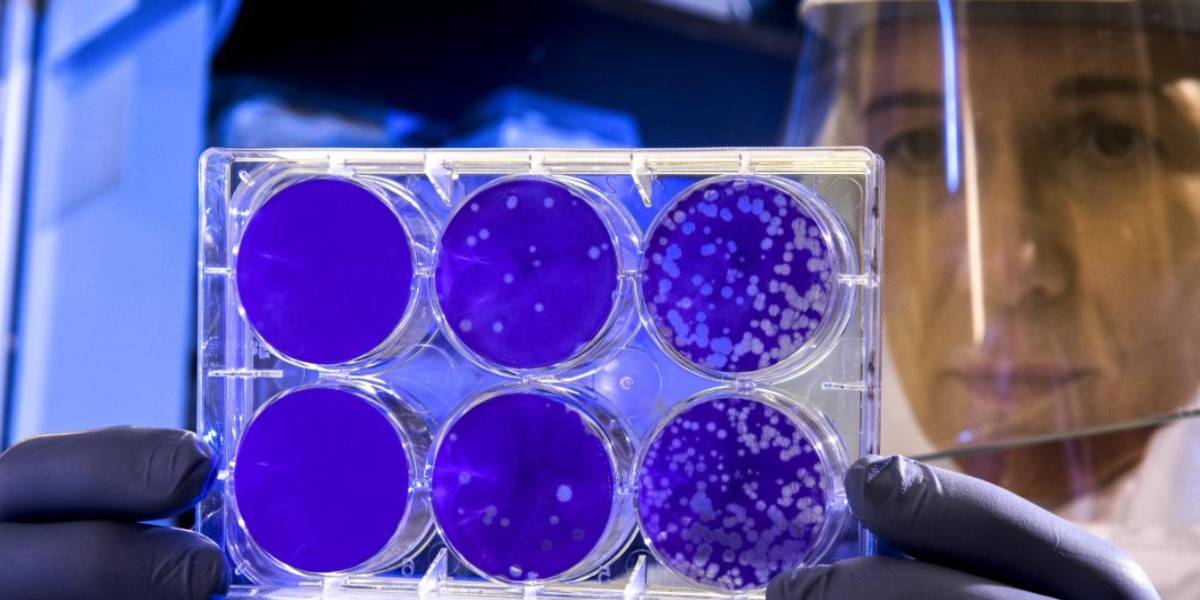 Tercera dosis de Sinovac eleva inmunidad anti-COVID-19, según estudio