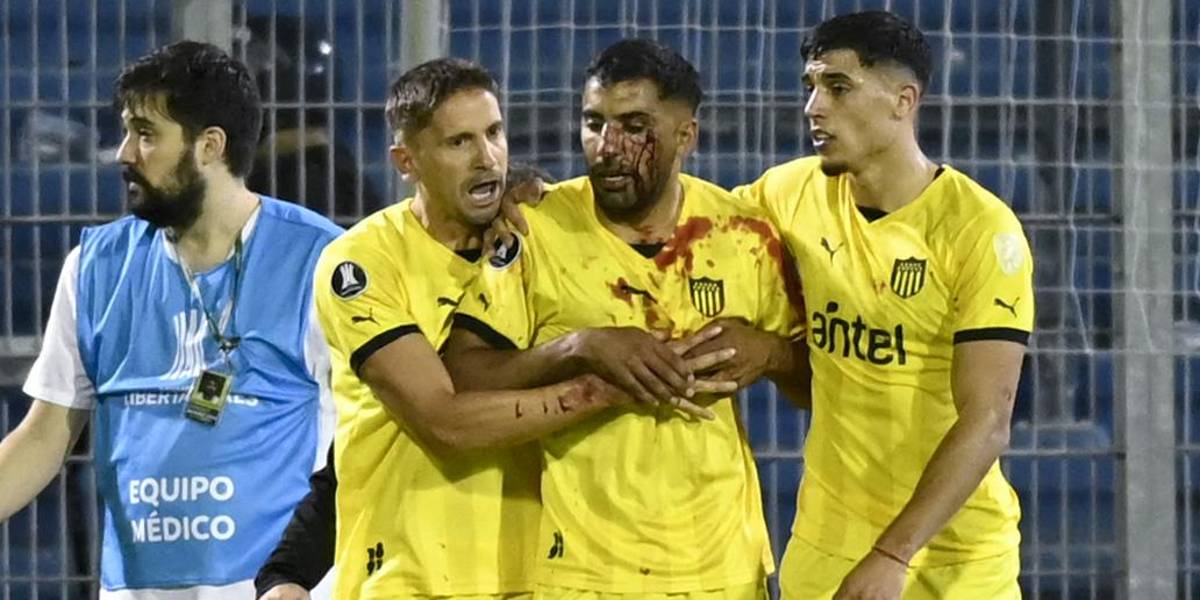 El uruguayo Maxi Oliveira es agredido por fanático de Rosario Central