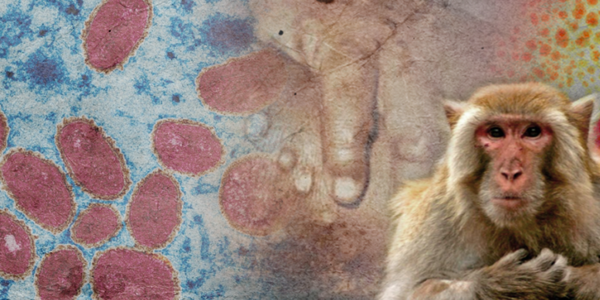 MSP anunciará este lunes medidas para enfrentar la viruela del mono