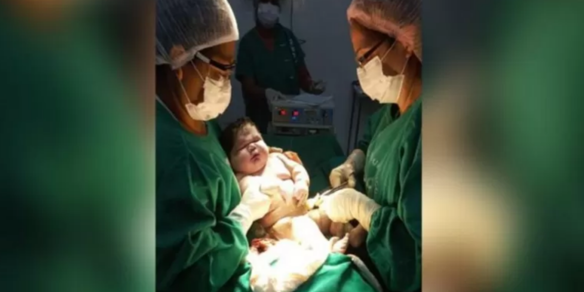 Nace un bebé gigante de 16 libras en Brasil: ¿cuáles son las causas y los riesgos de la macrosomía?
