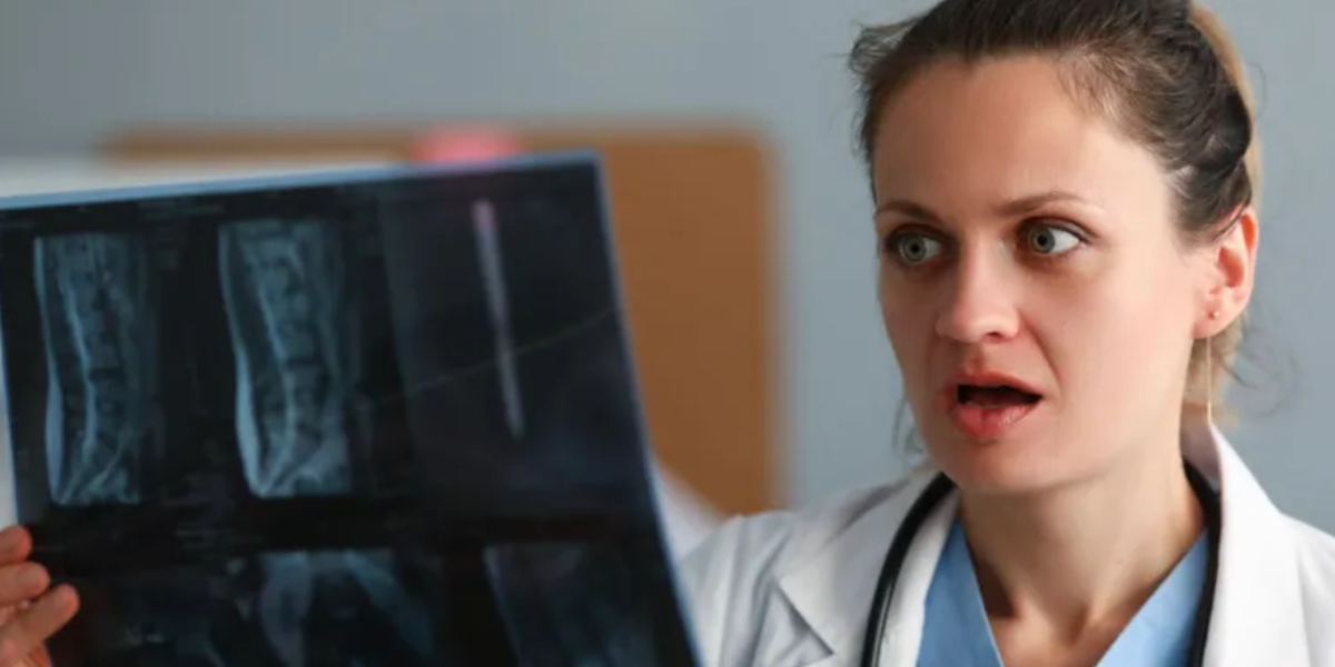 Los curiosos objetos y animales que los médicos han encontrado dentro del cuerpo humano