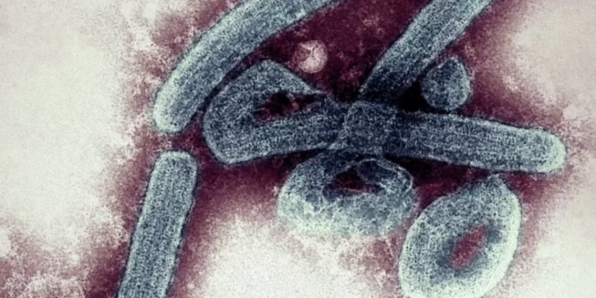 Virus de Marburgo: preocupación en Ghana por los primeros dos casos de la mortal enfermedad