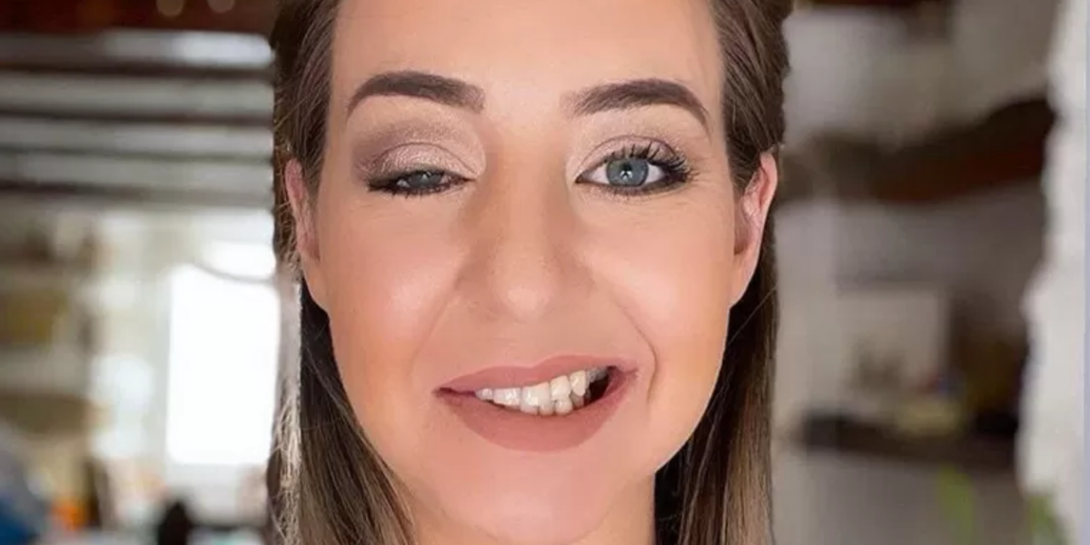 Síndrome de Ramsay Hunt: cómo es vivir con la condición que sufre Justin Bieber