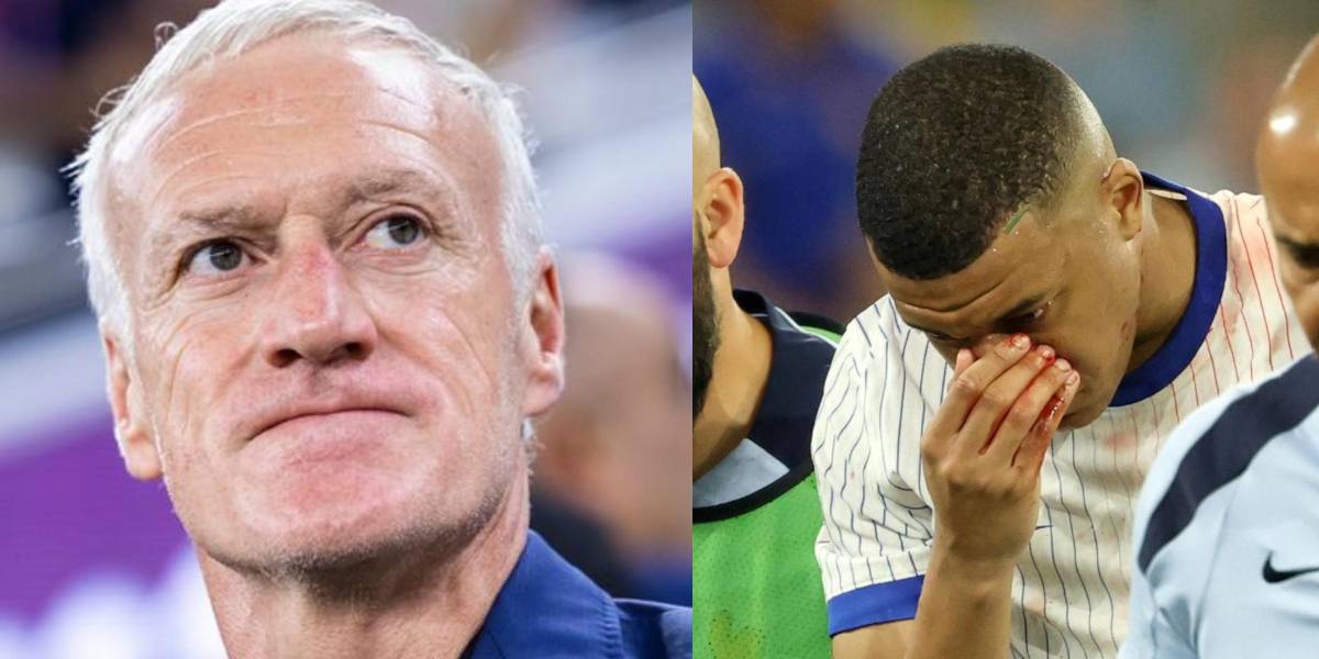 Didier Deschamps, DT de Francia, asegura que Mbappé se debe operar, pero no por el momento