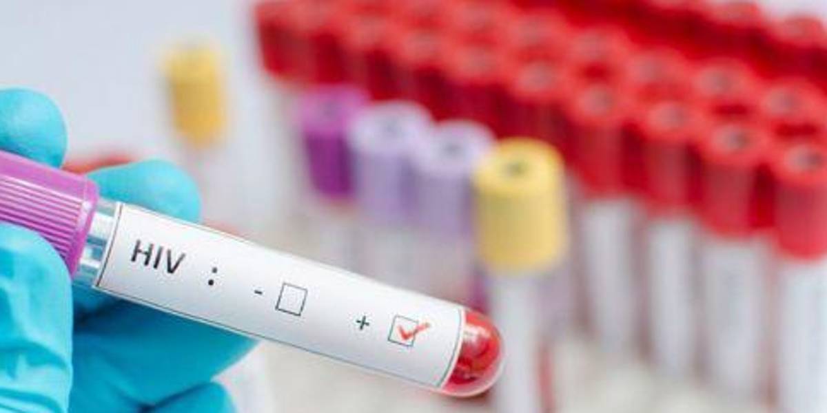 España considera que erradicar el VIH es cuestión de voluntad política