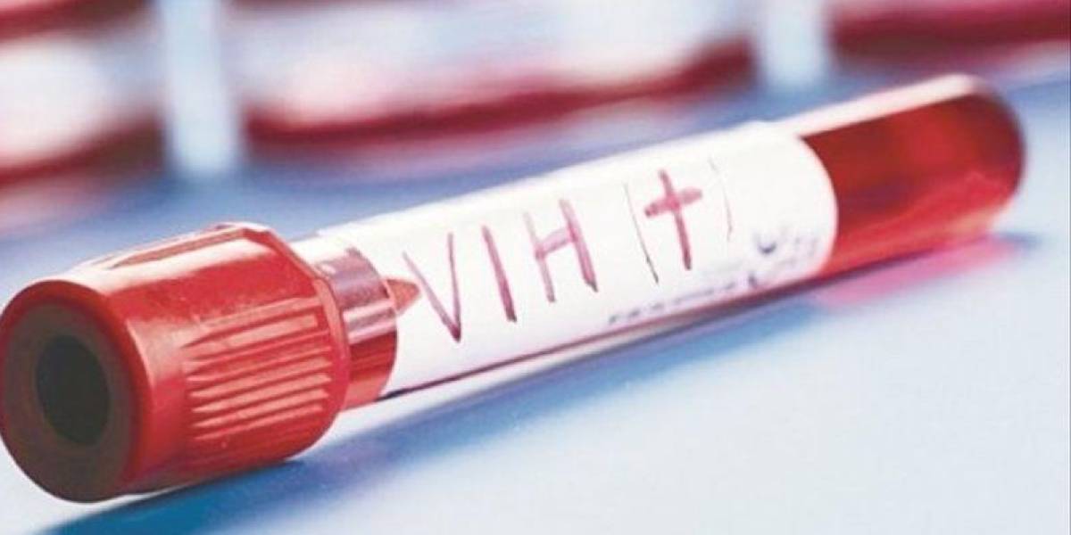 Identifican en un estudio variante más virulenta del VIH