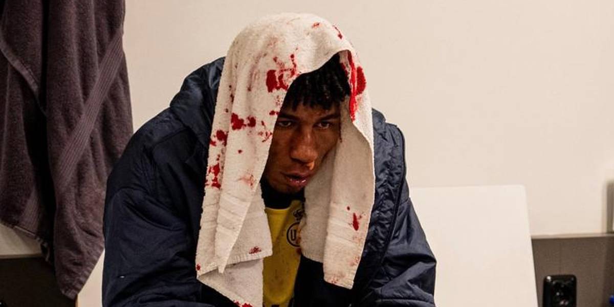 Kevin Rodríguez se fracturó la nariz en la Europa League