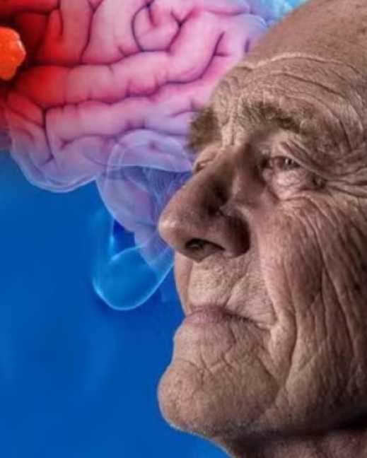 Imagen referencial. Persona con Alzheimer.