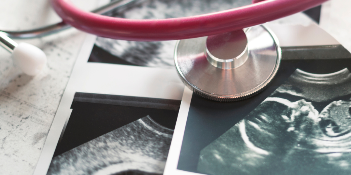 Una mujer brasileña con un feto calcificado desde hace 30 años falleció una operación