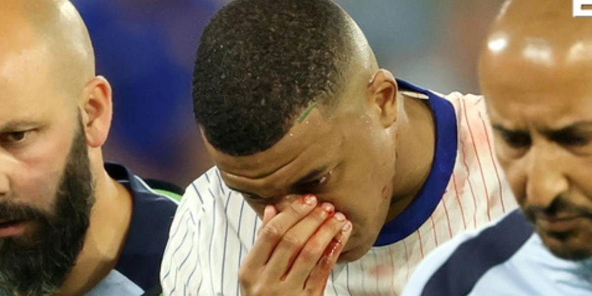 Mbappé saliendo del terreno de juego luego de su fractura.