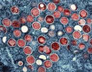 Estados Unidos ha confirmado más de 6.600 casos de viruela símica en 48 estados.