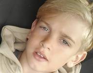 Esta foto proveída por Hollie Dance muestra a su hijo Archie Battersbee. Archie, de 12 años y que ha estado en coma durante cuatro meses, falleció el sábado, 6 de agosto del 2022 en un hospital en Londres. AP