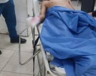 Imagen de Eddy R., el extorsionador que perdió la mano al atentar contra una importadora de repuestos.