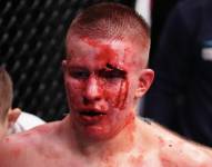 Mark Vologdin, peleador ruso luego de perder contra Adrián Luna.