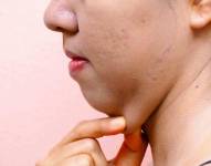 Papada mujer. Wikipedia