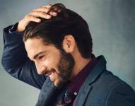 De entre los distintos tipos de caída de cabello, la calvicie común (alopecia androgénica) es la más común (Foto: Europa Press)