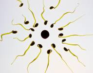 Espermatozoides masculinos. Foto: Pixabay