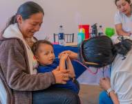 Imagen referencial de atención a niños con fisura de labio.