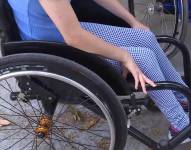 Imagen de una paciente con una enfermedad rara.