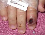 La guía preventiva ante la viruela del mono se encuentra en la cuenta de Twitter del Ministerio de Educación.