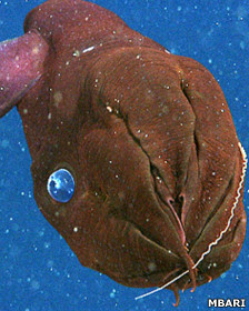 Los riesgos de la cirugía bariátrica