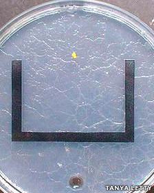 Los riesgos de la cirugía bariátrica