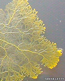 Los riesgos de la cirugía bariátrica