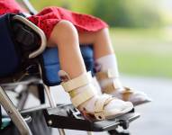 Foto referencial a Atrofia Muscular Espinal.