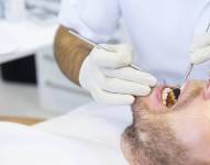 Dentista, boca, paciente. Periodontitis.ZLIKOVEC / ZLIKOVEC (Foto de ARCHIVO)31/7/2015