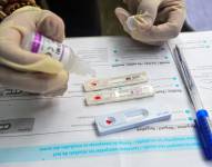 Un técnico médico voluntario analiza una muestra de sangre de estudiantes voluntarios de un programa gratuito de pruebas de VIH. Imagen de stock.