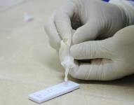 Cruz Roja reporta que se toman mil muestras diarias en el país para identificar COVID-19
