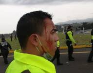 Policías heridos el martes 26 de octubre en varias zonas del país. Foto: Ministerio de Defensa.
