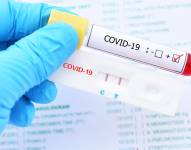 Brasil registra casi 100.000 casos de covid en 24 horas por variante ómicron