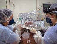 El novedoso equipo fue desarrollado por la Escuela de Salud Pública de Ceará.