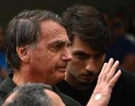 El expresidente de Brasil, Jair Bolsonaro, sale del hospital DF Star tras someterse a un procedimiento médico este domingo, en Brasilia (Brasil).
