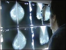 Los ocho síntomas clave del cáncer