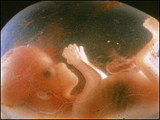 Estudian vínculo entre edad de las madres y problemas con óvulos