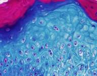 Imagen ampliada con un microscopio de una muestra de piel de un mono infectado con la viruela.