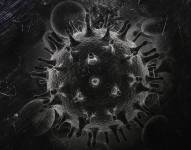 La mujer recibió un trasplante de células madre procedentes de un cordón umbilical, suplementado con células adultas donadas por un familiar.