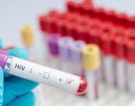 España considera que erradicar el VIH es cuestión de voluntad política
