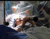 Una paciente con Parkinson tocó el clarinete mientras era operada del cerebro en Londres.