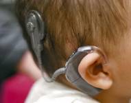 Quito: ladrones roban el procesador de oído de un niño con discapacidad auditiva
