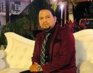 El actor Miguel Santana revela que necesita una prótesis tras la amputación de su pie izquierdo