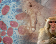 La viruela del mono, enfermedad endémica en África oriental y central, es menos peligrosa que la viruela convencional.