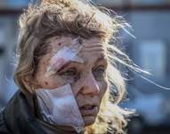 Una mujer que resultó herida por los bombardeos rusos se convirtió en objeto de teorías de conspiración y afirmaciones falsas en internet.