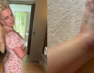 La Cantante Britney Spears nuestra su tobillo lastimado tras un incidente en un hotel.