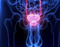 Examen de cáncer de próstata. Foto: Pixabay/Archivo