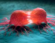 Proteína que alimenta el cáncer